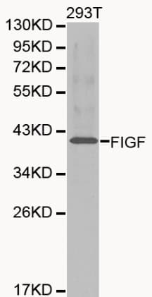 Polyclonal Rabbit anti-Human VEGFD Antibody (IHC, WB)