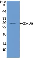 COMP / THBS5 Antibody (aa554-753)