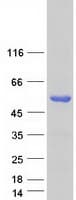 Human FOXL2 Protein (Recombinant Myc-DDK (Flag))
