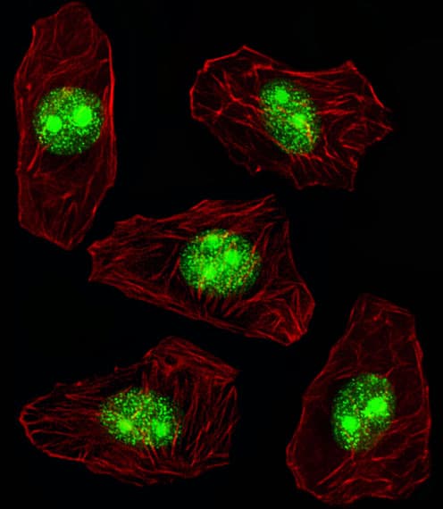 NPM1 / NPM / Nucleophosmin Antibody (aa7-33)