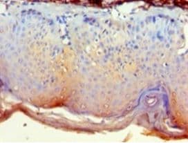 GRB4 / NCK2 Antibody (aa1-380)