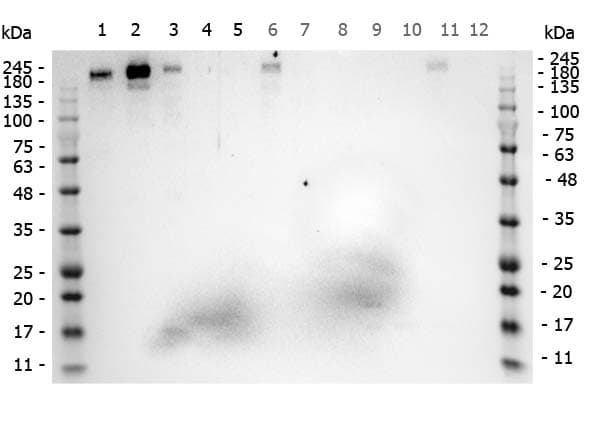 Polyclonal Rabbit anti-Human ROBO1 Antibody (aa1625-1650, IHC, IF, WB)