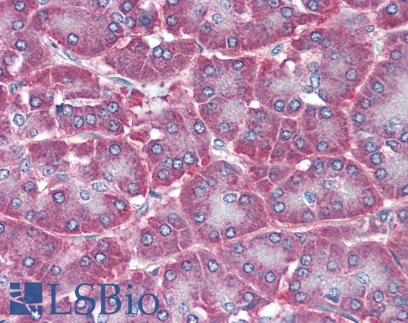 IHC-plus™ NT5E / eNT / CD73 Antibody (aa27-252, clone 2B6)