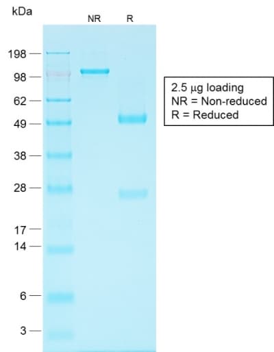 PathPlus™ EPCAM Antibody (clone EGP40/1556R)
