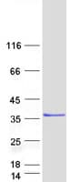 Human ZMYND19 Protein (Recombinant Myc-DDK (Flag))