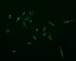 ACAA2 Antibody (clone OTI2G6)
