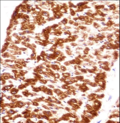 DES / Desmin Antibody (aa332-359)