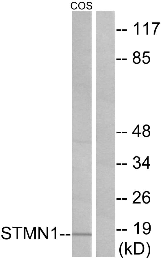 IHC-plus™ STMN1 / Stathmin / LAG Antibody (aa9-58)