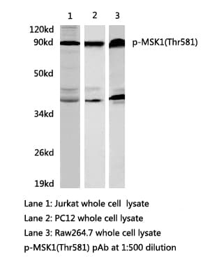 RPS6KA5 / MSK1 Antibody (phospho-Thr581)