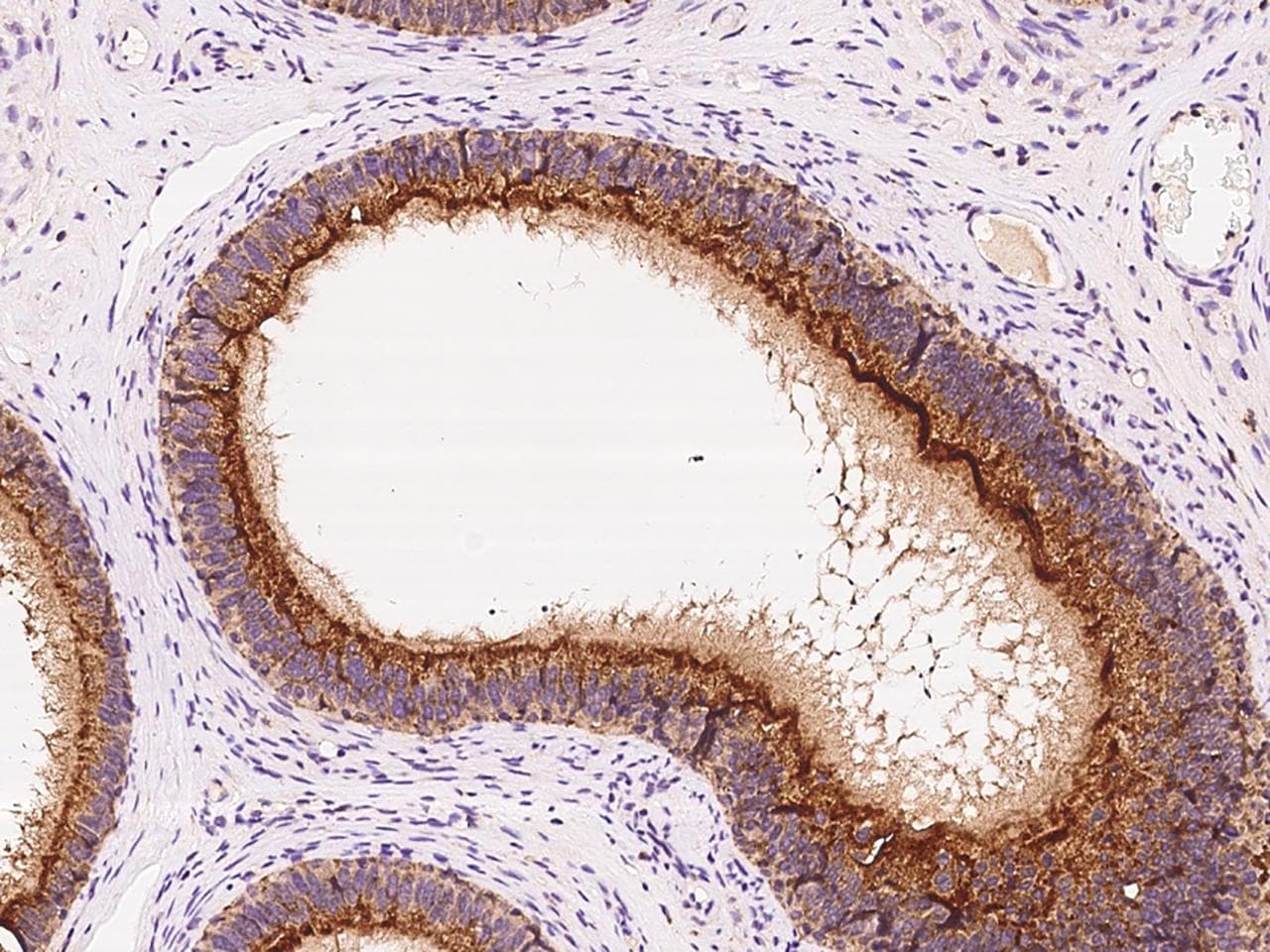 GLB1 / Beta-Galactosidase Antibody