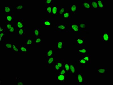 HIST1H4I Antibody