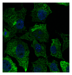 IHC-plus™ CAV1 / Caveolin 1 Antibody (N-Terminus)