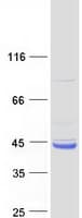 Human WDR92 Protein (Recombinant Myc-DDK (Flag))