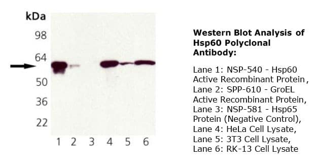 PathPlus™ Polyclonal Goat anti-Human HSPD1 / HSP60 Antibody (IHC, WB)