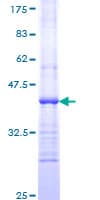 Human Hamartin / TSC1 Protein (Recombinant GST, N-terminus)