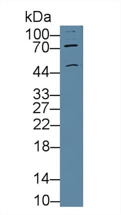 CHRNA3 Antibody (aa32-240, APC)