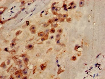 CLEC7A / Dectin 1 Antibody