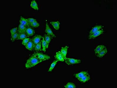 Polyclonal Rabbit anti-Human LGALS9 / Galectin 9 Antibody (aa1-240, IHC, WB)