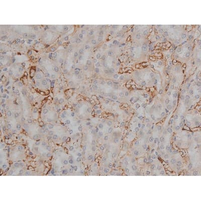MAPT / Tau Antibody (phospho-Thr231)