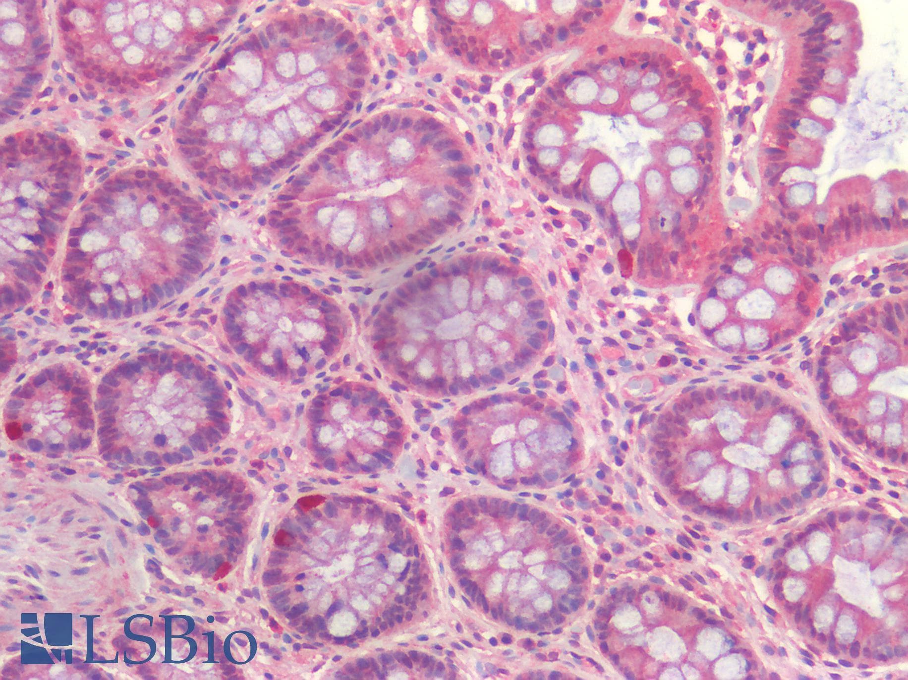 IHC-plus™ Polyclonal Rabbit anti-Human CASP3 / Caspase 3 Antibody (IHC)