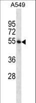 STAMBP / AMSH Antibody (aa355-383)