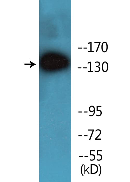 Polyclonal Rabbit anti-Human INPP5D / SHIP1 / SHIP Antibody (phospho-Tyr1020, WB)
