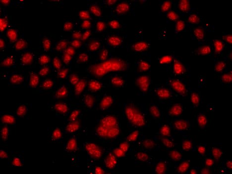 Polyclonal Rabbit anti-Human FBXW11 Antibody (IHC, IF, WB)