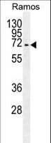 IHC-plus™ KNG1 / Kininogen / Bradykinin Antibody (aa138-166)
