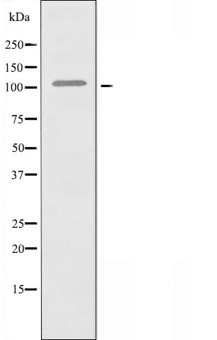 BTF / BCLAF1 Antibody