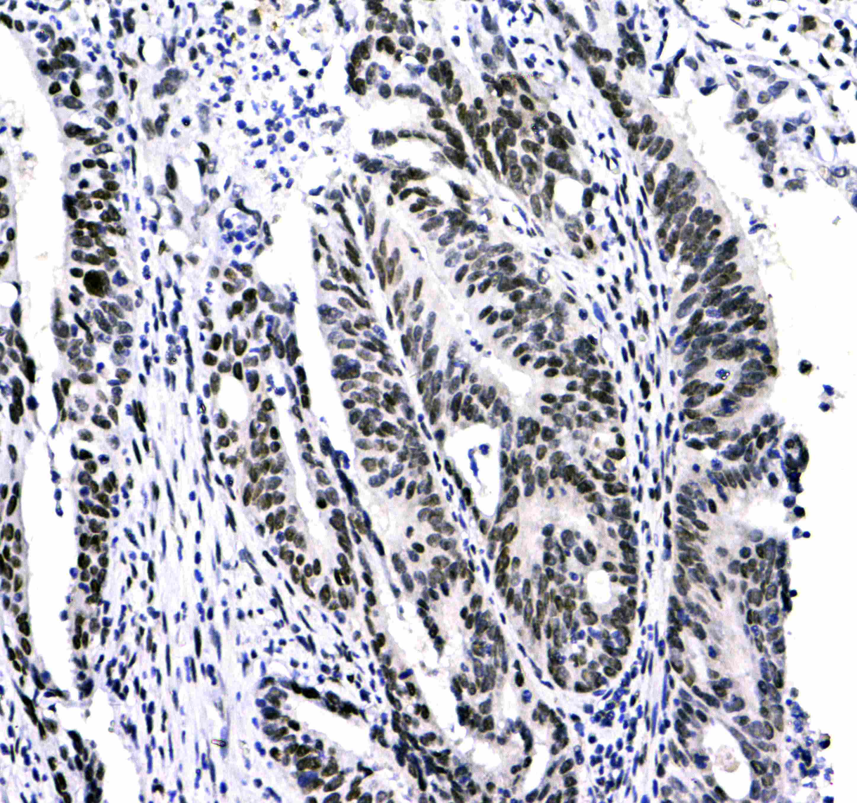 CBX3 / HP1 Gamma Antibody