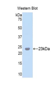 PXDN / MG50 Antibody (aa1285-1475)