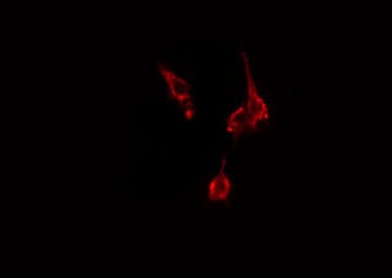 ABCD4 Antibody