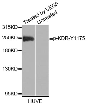 KDR / VEGFR2 / FLK1 Antibody (phospho-Tyr1175)