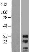 LIME1 / LIME Protein (Over-Expression Lysate Myc-DDK (Flag))