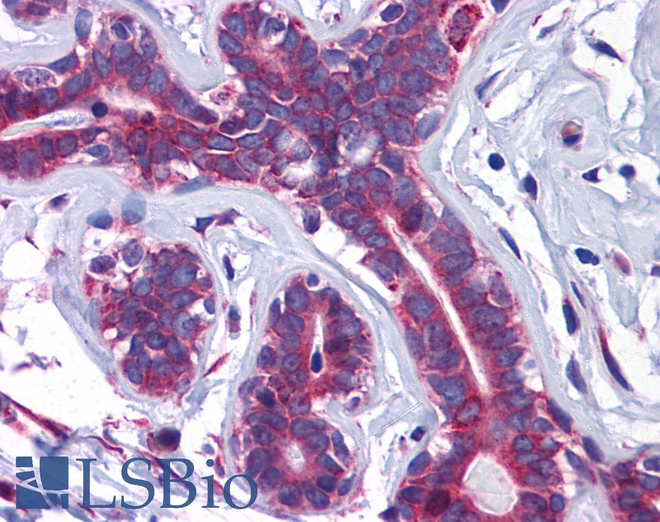 IHC-plus™ Polyclonal Rabbit anti-Human SLC39A7 / ZIP7 Antibody (IHC, IF, WB)