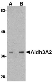 ALDH3A2 Antibody