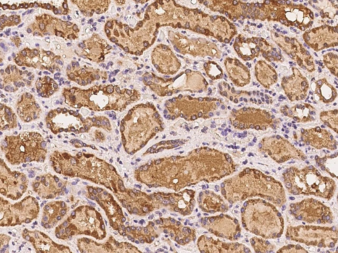 Polyclonal Rabbit anti-Human MTBP / Mdm2-Binding Protein Antibody (IHC)