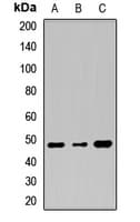 Polyclonal Rabbit anti-Human TMPRSS11A Antibody (WB)