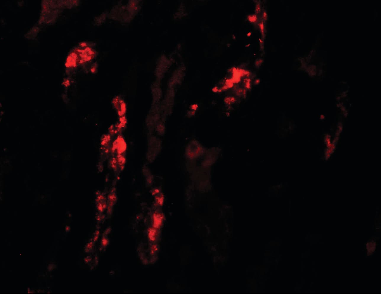 KANK1 Antibody