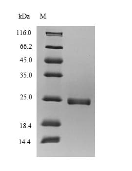 Atlantic salmon Vertebrate ancient opsin Protein (Recombinant 6His-SUMO, N-terminus)