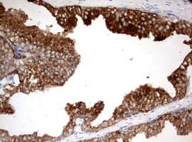 KLK2 / Kallikrein 2 Antibody (aa25-261, clone OTI5D6)
