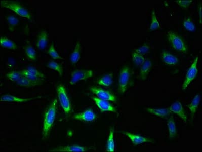 Polyclonal Rabbit anti-Human TSC501 / NAT8 Antibody (IHC)
