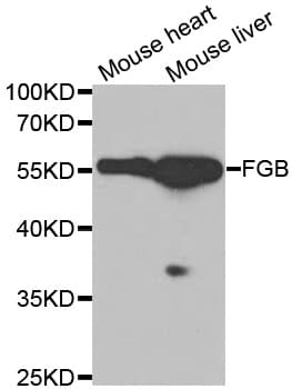 Polyclonal Rabbit anti-Human FGB / Fibrinogen Beta Chain Antibody (IHC, WB)