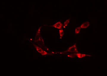 ADCK4 Antibody