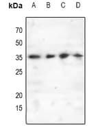 CEBPD + CEBPE Antibody