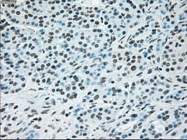 BRAF / B-Raf Antibody (clone OTI3B12)