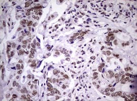 NBN / Nibrin Antibody (clone OTI6E11)