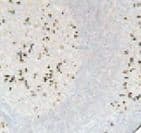 Mouse Anti-Human Kappa Light Chain Secondary Antibody (Ready-to-Use)
