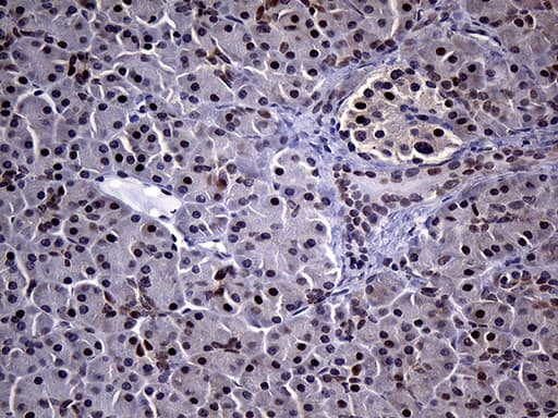 SDCCAG1 / NEMF Antibody (aa869-1076, clone OTI7E10)