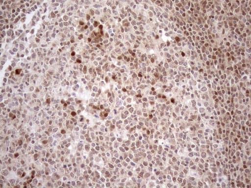 MGMT Antibody (clone OTI4F9)
